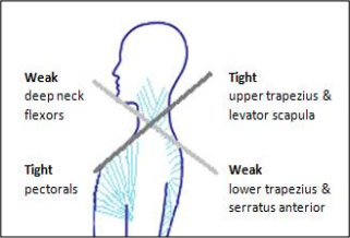 Illustration showing muscles in upper torso